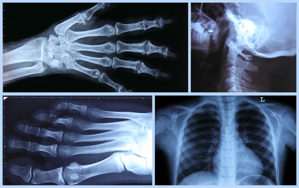 radiologie-imagerie-medicale